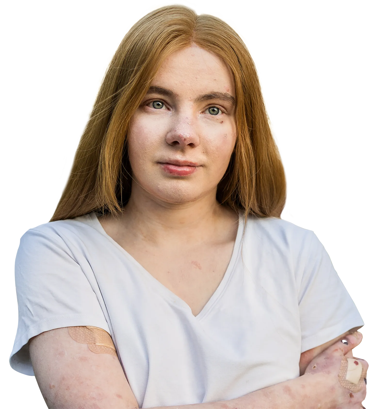 Pieni ele - tietoa keräyksestä